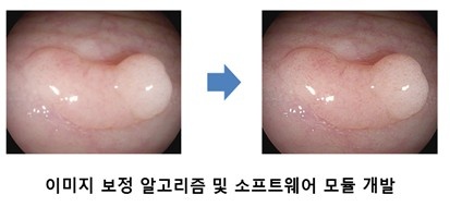 Windows 내시경 뷰어 UI 화면