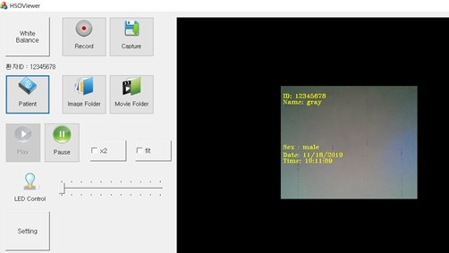 Windows 내시경 뷰어 UI 화면