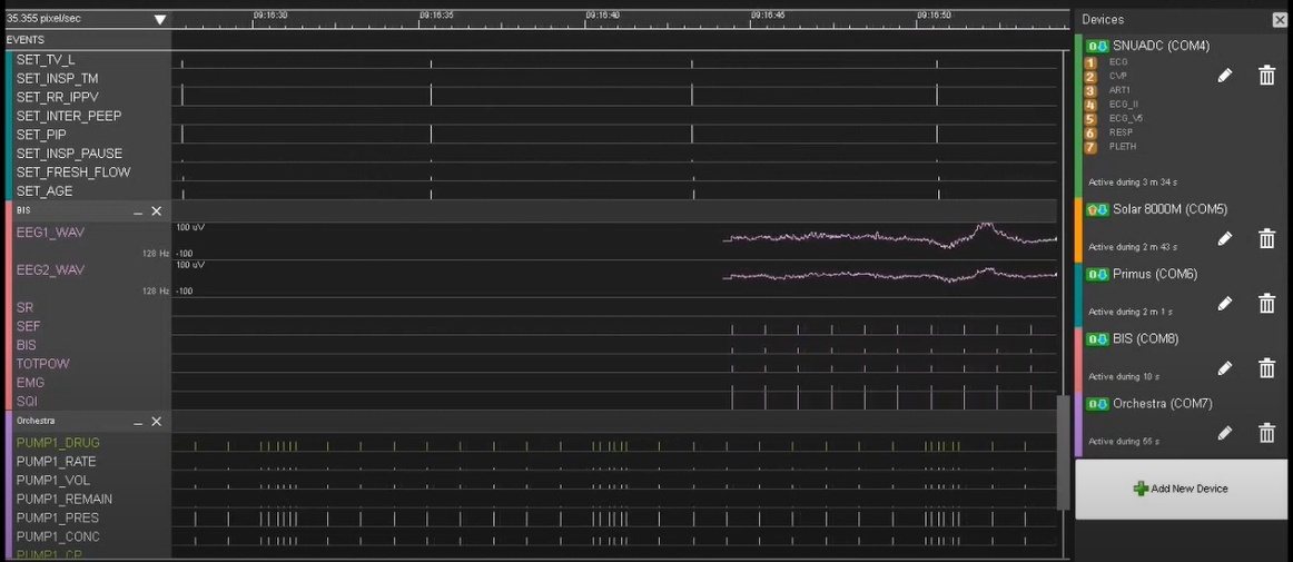 웨어러블 디바이스 또는 시스템 구성