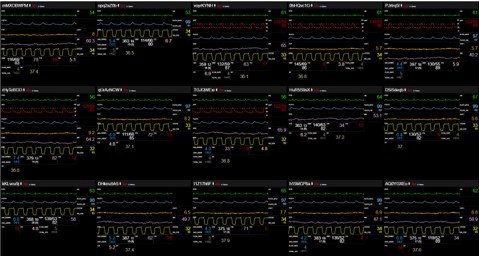 게이트웨이 또는 모니터링 UI 화면